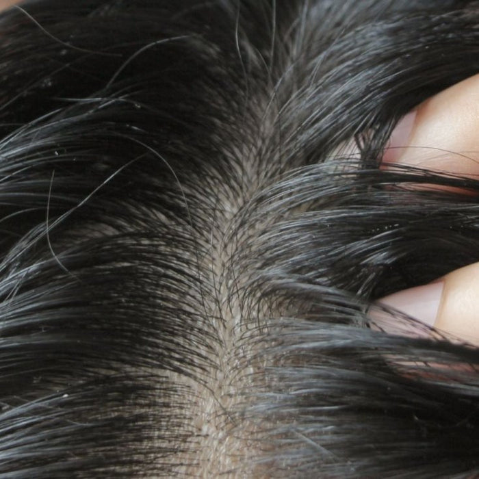 Hvordan bli kvitt fett hår? - Cancam